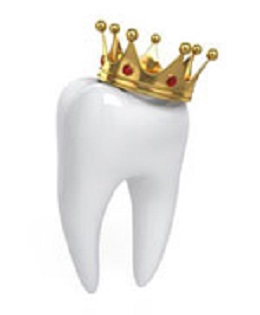 Dental Crowns Reston